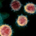 coronavirus_SARS-CoV-2-wiki_niaid--20200310